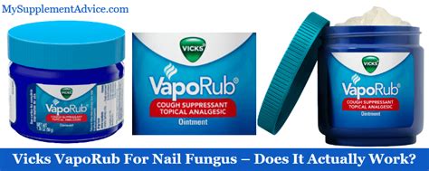 Vicks VapoRub For Nail Fungus Does It Actually Work Supplementox