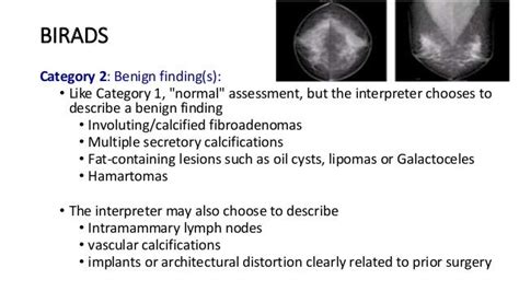 Breast Imaging