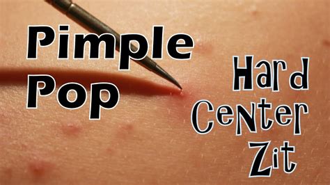 Pimple Pop Hard Center Zit High Definition 1080p Youtube