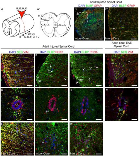 Spinal Cord Radial Glia Expand And Transform Morphologically During The