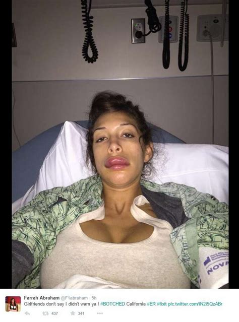 Porn Star Farrah Abraham S Plastic Surgery Goes Terribly Wrong She Owns It Houston Chronicle