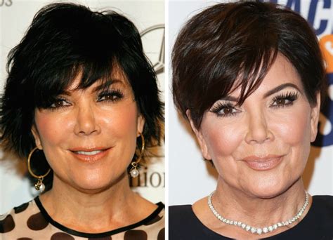 kardashian sisters who s gotten the most surgery life and style