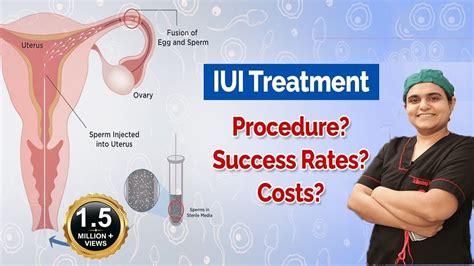 Iui Treatment For Pregnancy In Hindi Cost Success Tips Is Painful