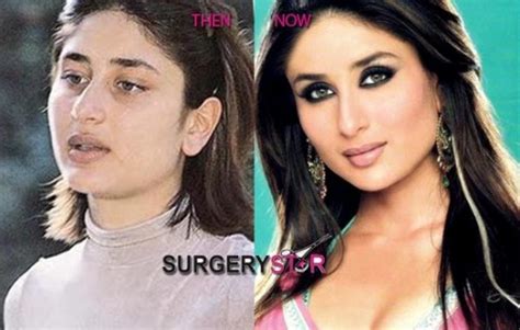 10 bollywood actresses who went through plastic surgery
