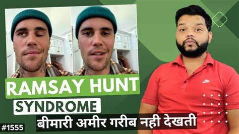 Ramsay Hunt Syndrome Causes Symptoms And Treatment Youtube