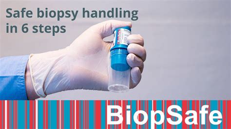 Safe Biopsy Handling In Easy Steps YouTube