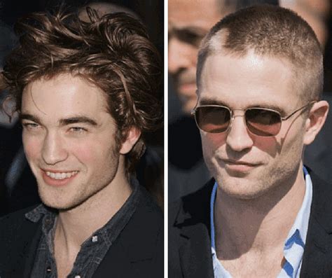 Male Celebrities With Hair Loss Celeb With Baldness
