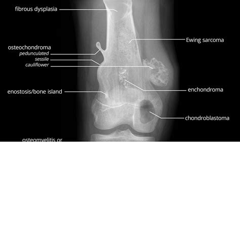 Antrim Ed Meducation Just A Simple Site For Ed Meducation Page 5