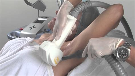Diode laser hair removal machine,fast and painless skin rejuvenation, beauty salon equipment. Laser Hair Removal - YouTube