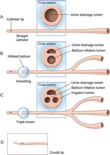Urinary Catheter Straight Indwelling Foley And Coudé Catheter Insertion And Specimen