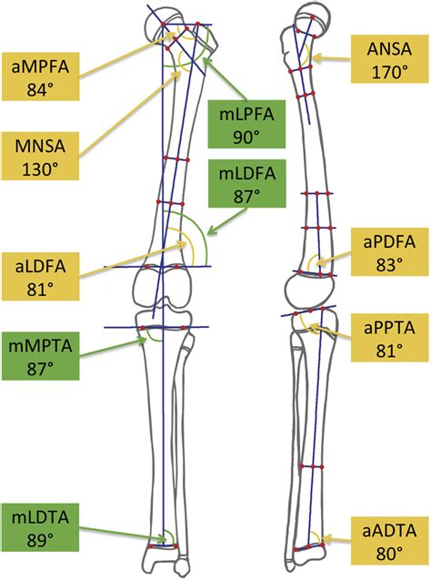 Lower Limb Alignment Orthopaedics And Trauma