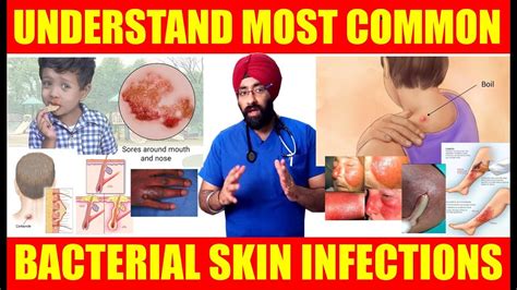 Most Common Skin Problems Bacterial Skin Infections Simplified In Eng
