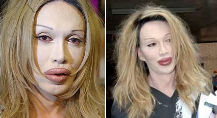 Horrible Cosmetic Surgery Disasters 1001 QuestionsKnowledge Science