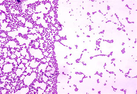 Public Domain Picture A Photomicrograph Of Streptococcus Mutans Bacteria Using Gram Stain