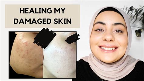 4 Changes I Made To Heal My Skin Barrier How To Repair Skin Barrier