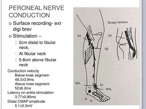 Nerve Conduction Studies Lower Leg