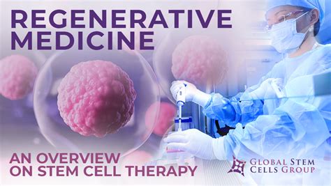 Regenerative Medicine An Overview On Stem Cell Therapy Global Stem