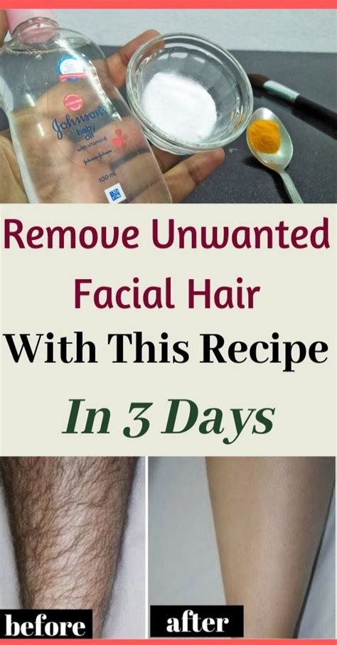 Remove Unwanted Facial Hair Permanently With This Recipe Healthy