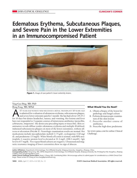 Edematous Erythema Subcutaneous Plaques And Severe Pain In The Lower