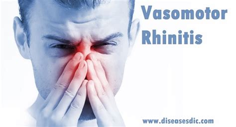 Vasomotor Rhinitis Or Nonallergic Rhinitis Causes And Treatment