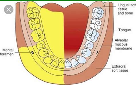 The Posterior Superior Alveolar Nerve Block Dental An