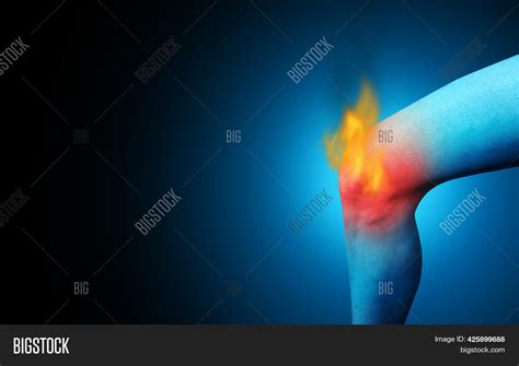 Painful Knee Joint Image And Photo Free Trial Bigstock