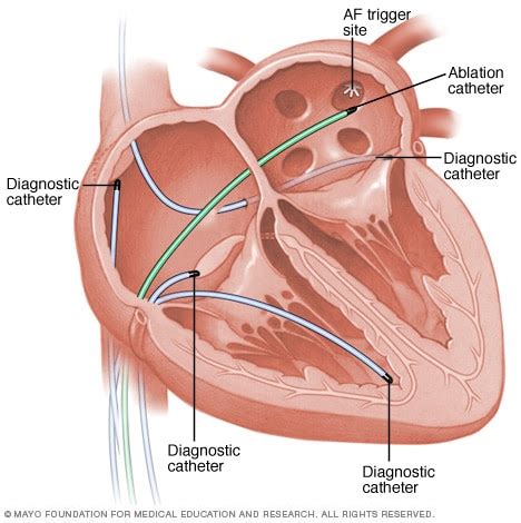 El Cuerpo Humano Avances Tecnol Gicos En Cardiolog A Que Te Sorprender N
