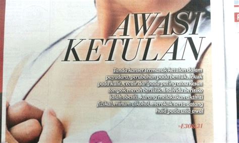 Tahap 2 pada tahap serta peringkat yang kedua ini, ukuran ketumbuhan barah payudara akan meningkat antara 2 cm hingga 5 cm. KANSER PAYUDARA TAHAP 4 DI USIA MUDA,TAPI KINI BEBAS ...