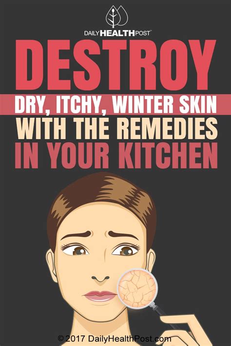 Destroy Dry Itchy Winter Skin With The Remedies In Your Kitchen
