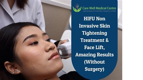 Face Lift By Hifu Treatment And Other Producers In Delhi Care Well