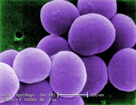 Filestaphylococcus Aureus Visa Wikipedia