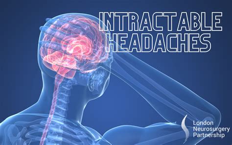 Intractable Headaches Treatments And Conditions