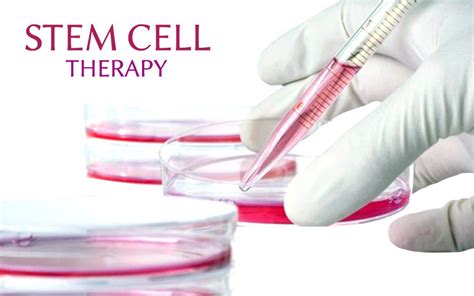 Stem Cell Therapy Shows Potential In Treating Medication Resistant