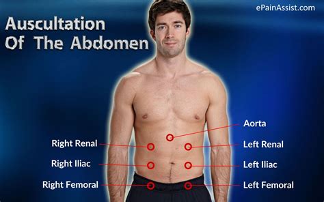 Location Of Arteries In Abdomen To Auscultate For Bruits Aorta Renal Iliam Abdominal