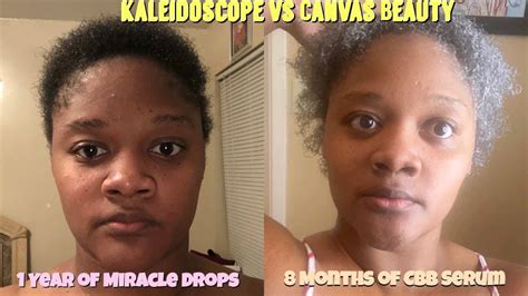 Hair serum can reduce frizz, and add shine, flexibility and strength to your hair.v161640_b01. Kaleidoscope Miracle Drops vs. Canvas Beauty Hair Blossom ...