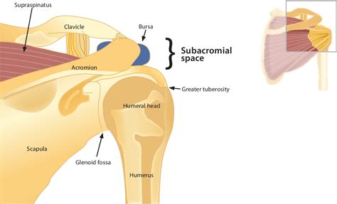Figure 1 From Shoulder Impingement Syndrome A Common Affliction Of The