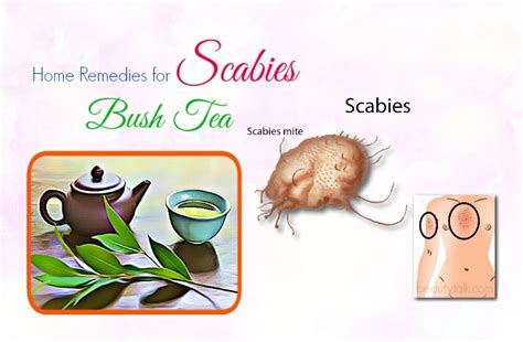 16 Science Based Natural Home Remedies For Scabies That Work