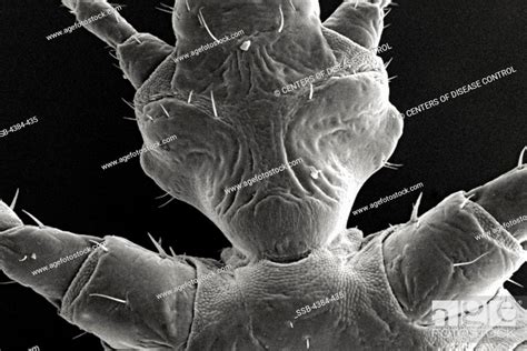 Microscopic Detail Of Female Body Louse S Exoskeletal Surface Stock