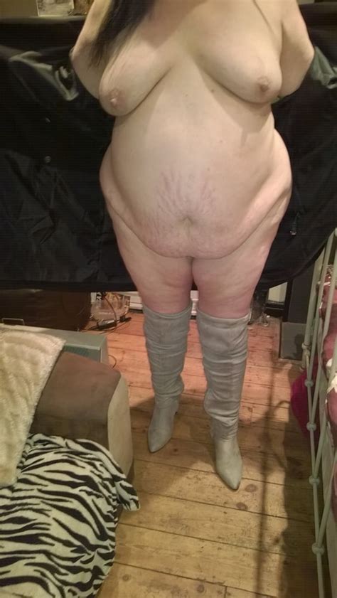 Filthy Slag Fat Slut White Slut Exposed 19 Pics Xhamster