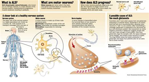 This Diagram Gives A Brief Overview And Explanation Of What Als And