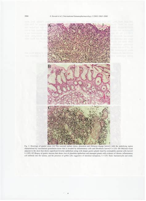 Pdf Histology Of Gastric Ulcer