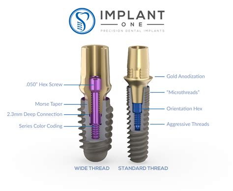 Top Dental Implant Systems And Implant Solutions Implant Logistics