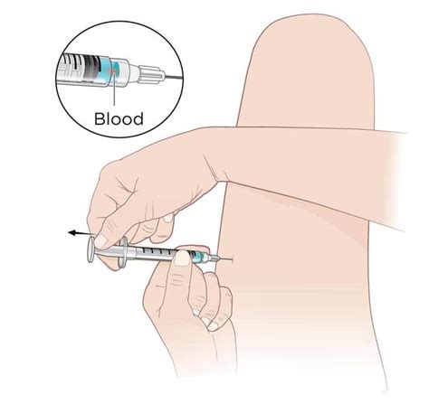 intramuscular injection definition and patient education patient education im injection