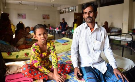 Bangladeshi Girl May Be First Female With Tree Man Syndrome Bbc News