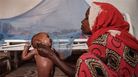 Sob Fome Da Seca Crianças Não Têm Força Para Chorar Na Somália