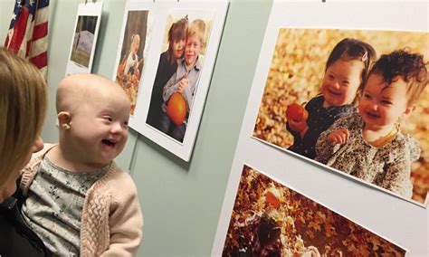 Moment A Down Syndrome Girl Battling Cancer Sees A Self Portrait Of