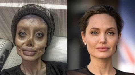 Si Sottopone A 50 Operazioni Per Somigliare Ad Angelina Jolie