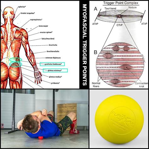 Myofascial Release Trigger Point Chart
