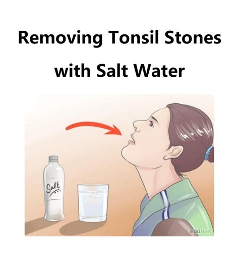 Removing Tonsil Stones With Salt Water