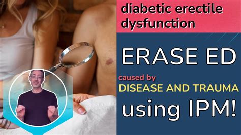 Diabetic Erectile Dysfunction Erase Ed Caused By Disease And Trauma Using Ipm Youtube
